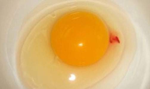 Kan Pıhtısı Olan Yumurtayı Yemek Zararlı Mı?